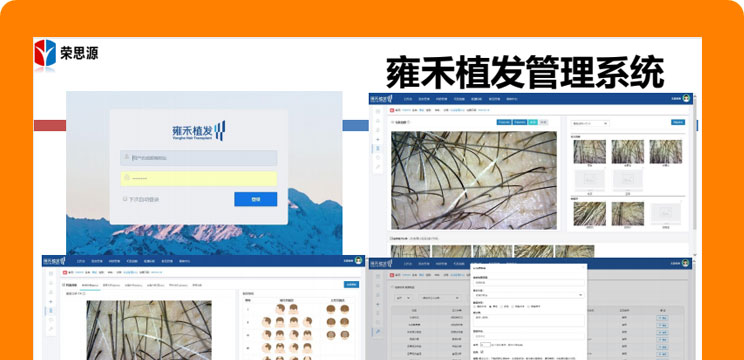 雍禾医疗植发管理系统